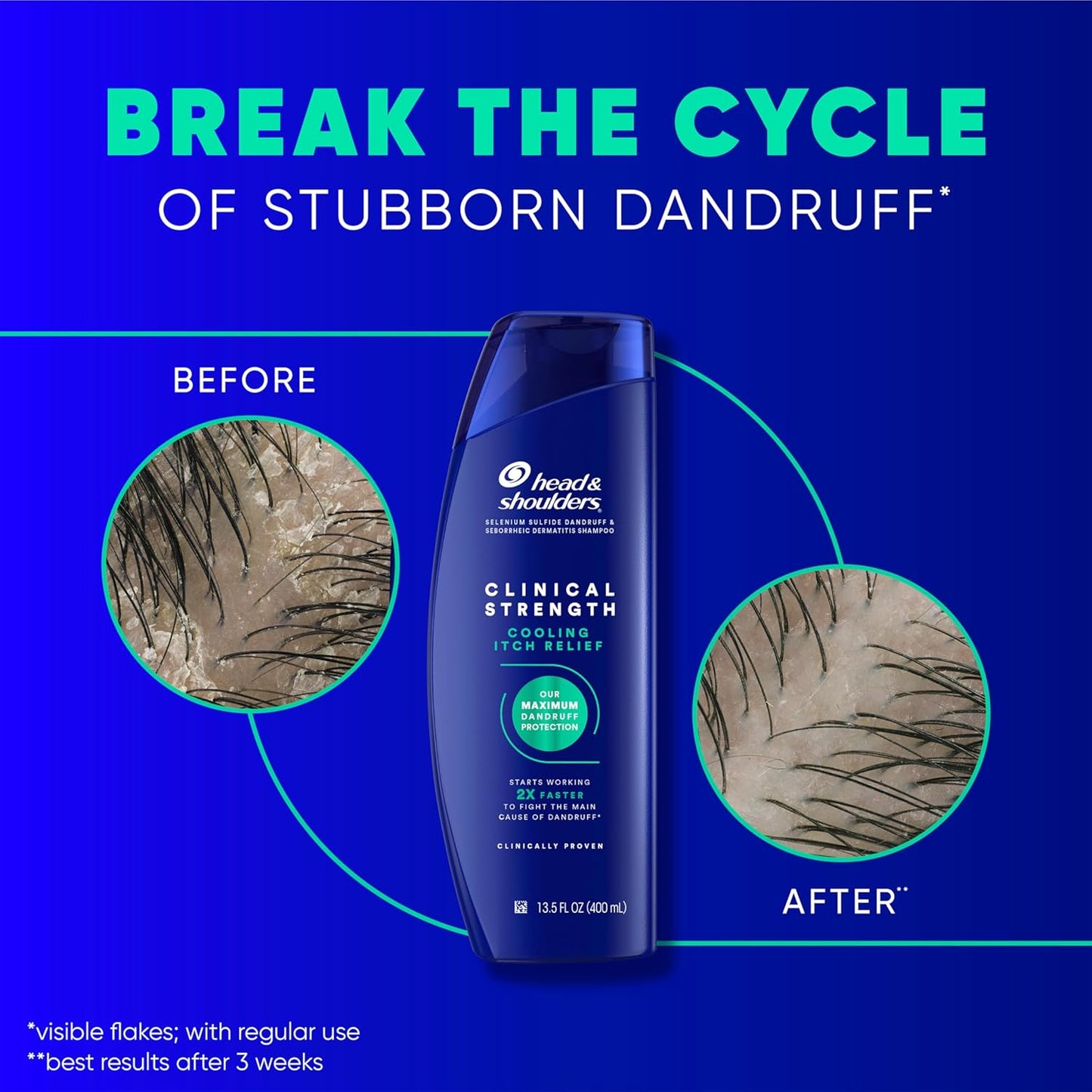 SHAMPOO ANTICASPA HEAD&SHOULDER COOLING ITCH RELIEF (VERDE)