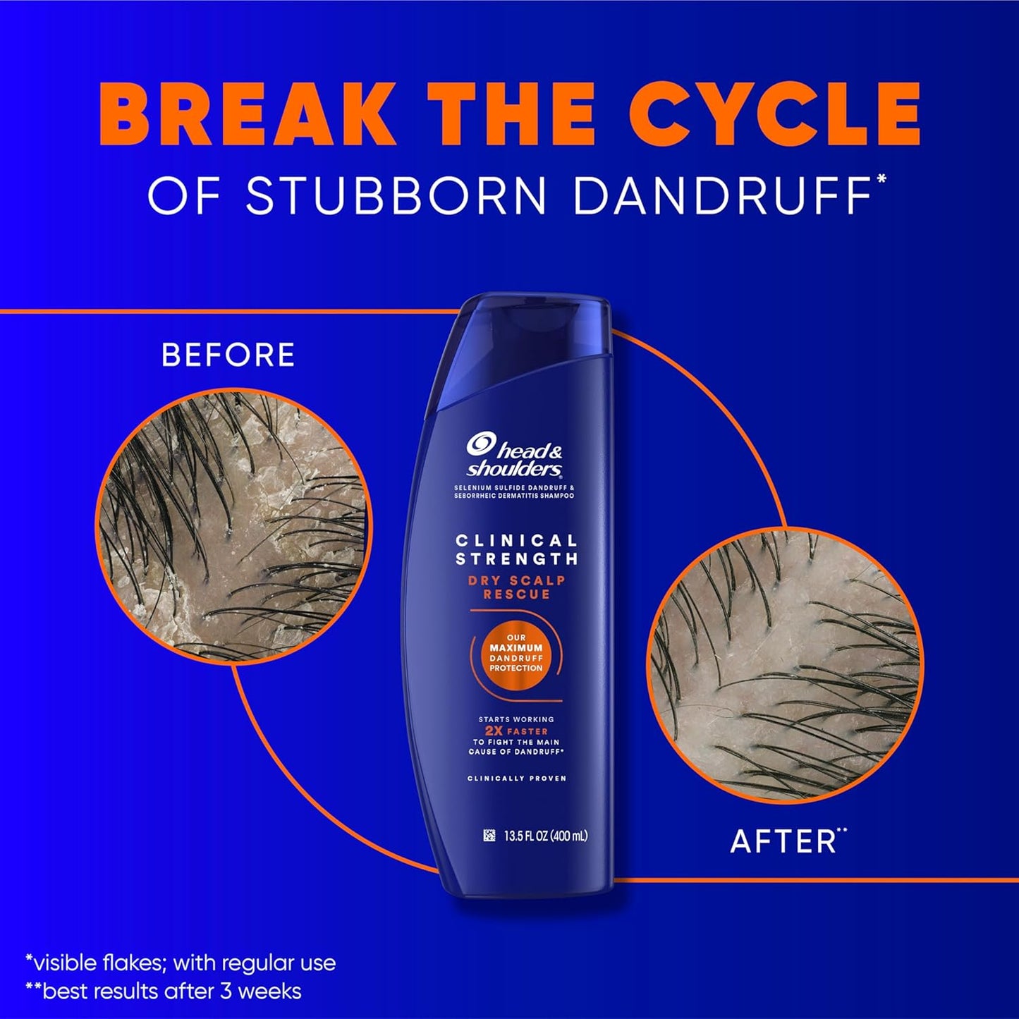 SHAMPOO ANTICASPA HEAD&SHOULDER DRY SCALP RESCUE (NARANJA)