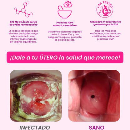 Óvulos de acido bórico - 600 MG (Bory Harmony)